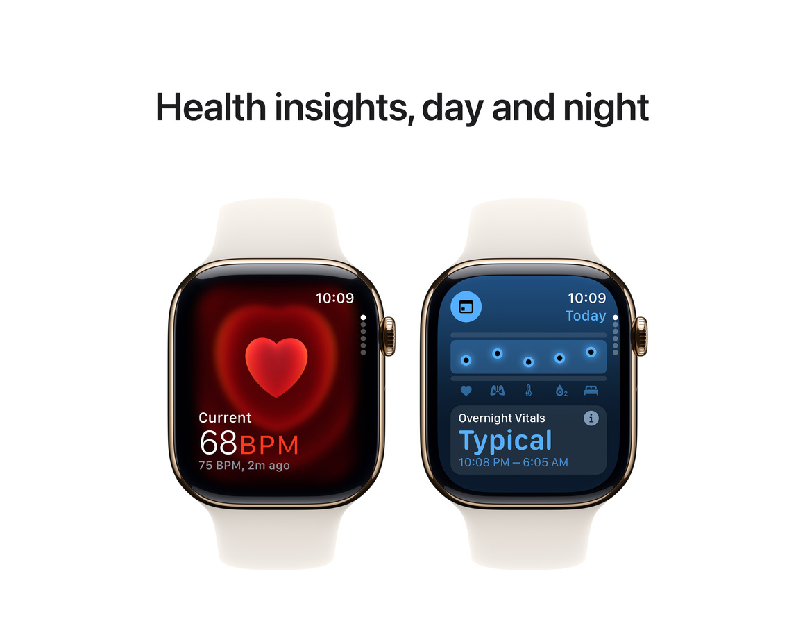 Apple Watch Series 10 GPS + Cellular 46mm Guld Titanboett med Stjärnglans Sportband - S/M