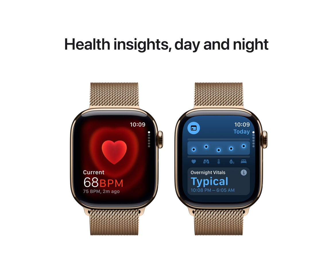 Apple Watch Series 10 GPS + Cellular 42mm Guld Titanboett med Guld Milanesisk loop